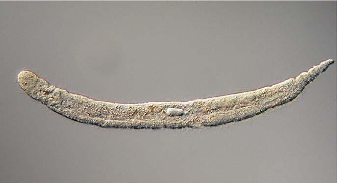 Gnathostomulida: Jaw Worms Marine, interstitial