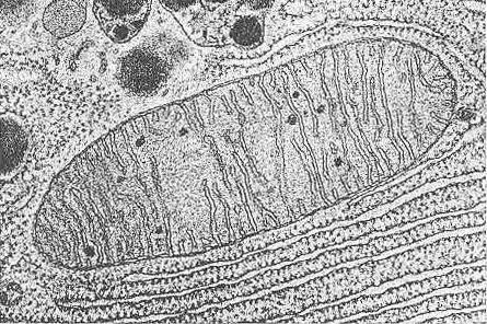 3. The electron micrographs below show mitochondria in longitudinal section.