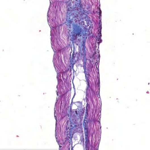 Many cells are embedded inside the collagen sheath