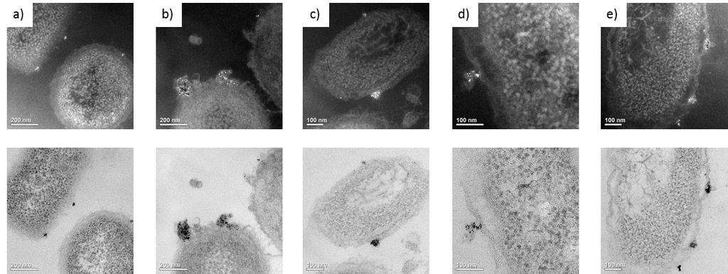 Figure S3. Dark field TEM images (top) highlighting the presence of PAH AuNPs (bright spots) due to their efficient scattering properties at particular diffraction angles, for a) A. baylyi ADP1, b) A.