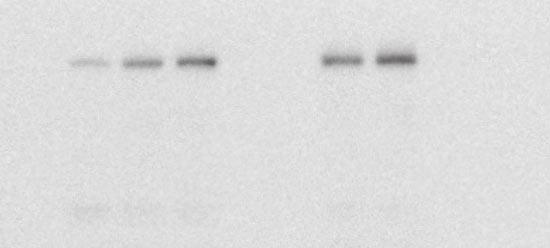 () PCR showing expression of c-met in spheroid cultured colon CSCs. Right pnel shows FACS nlysis for c-met.