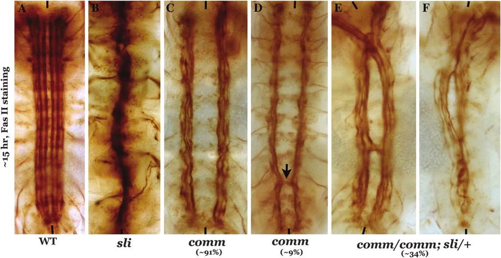 This was observed in 3% of embryos (n ¼ 106). These results argue that a significant number of embryos with guidance defects would make it to pupal stages.