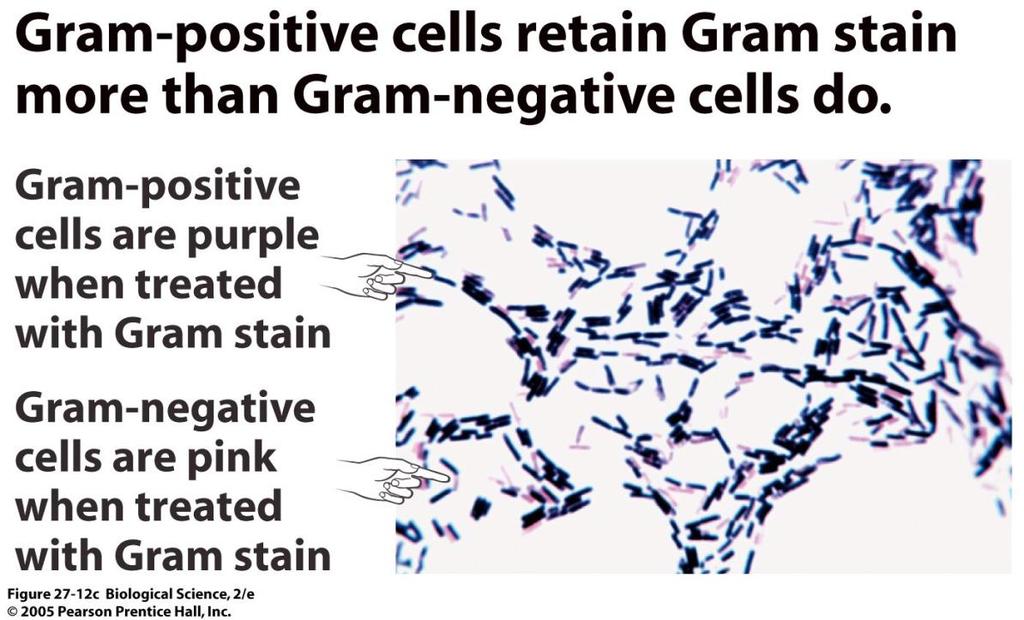 Gram-positive & Gram-negative 18 Why does this classification matter?