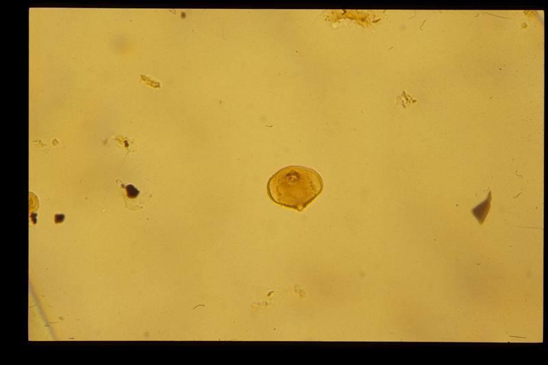 Evidence from vegetation in the past 0.1 mm A mangrove pollen Sonneratia sp. occurring within the M2 unit of the New Hong Kong Airport site.