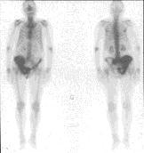 It permits : - the extent of the disease or non-normal functioning to be visualized with modern nuclear medicine imaging techniques, like scintigraphy or positron emission tomography (PET) - the