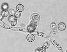 Saccharomycotina - the true budding yeasts (--> Saccharomycetes, or the Saccharomycetales in traditional classification systems). but now also includes filamentous forms in modern classification.