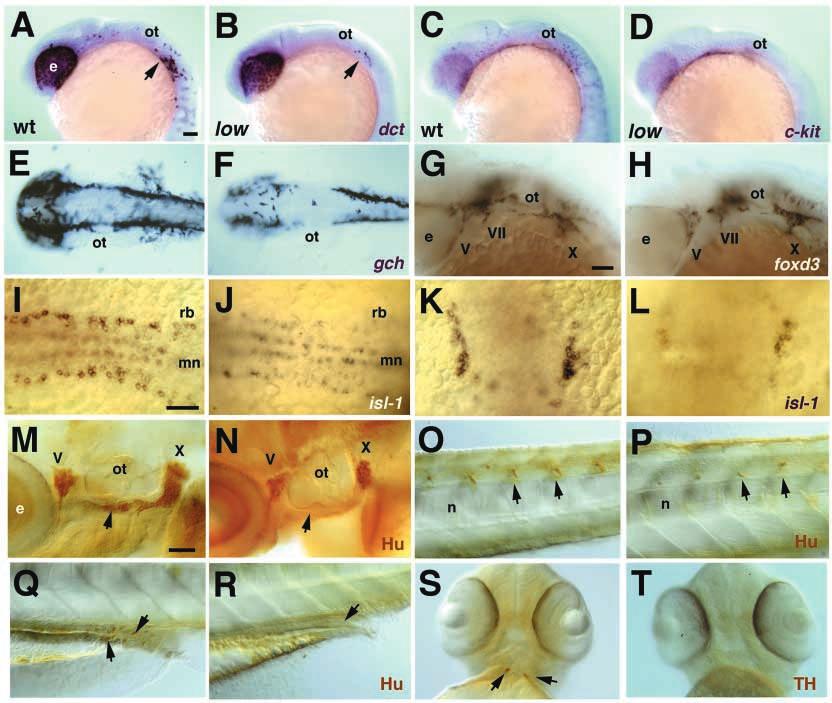 A zebrafish tfap2a mutant 5761 Fig. 5. Defects in pigment precursors, neuronal and glial derivatives of the neural crest.