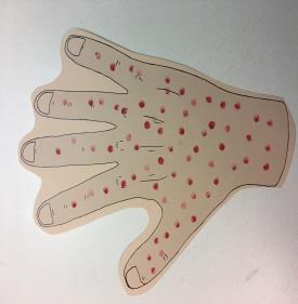 Show them how to make dots on one side of the hand, and remind them that Jesus helped the men with sores on their body.