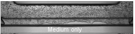 only 30 µm Cisplatin