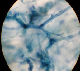 Arbuscules (40x) ; ( b) Glomus aggregatum associated with Allium cepa root (100x)