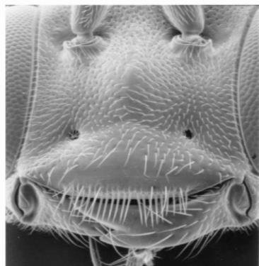 34); clypeus with a fringe of regular, closely spaced, strong setae on the apical edge (Fig.35), never with a tooth... Tersilochinae (a few) Fig.32 Propodeum, Anomaloninae Fig.