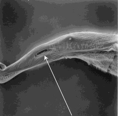 Fig.152 Tarsal claw, Pimplinae 91(82) Areolet present and pentagonal; fore trochantellus not differentiated from femur; clypeus covered in stiff hairs; mandible widened in apical half, lower tooth