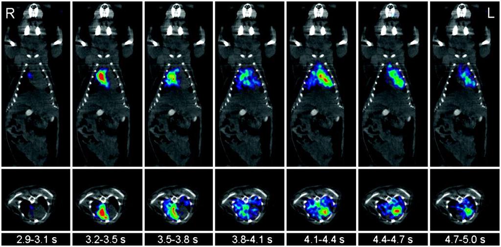Positron Emission Tomography Temporal resolution Consecutive 0.3-s frames show passage of tracer bolus through RV cavity, lungs, and LV chamber of mouse on coronal and transverse slices.