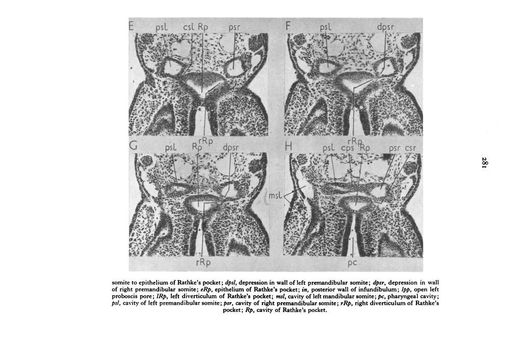 somite to epithelium of Rathke's pocket; dpsl, depression in wall of left premandibular somite; dpsr, depression in wall of right premandibular somite; erp, epithelium of Rathke's pocket; in,