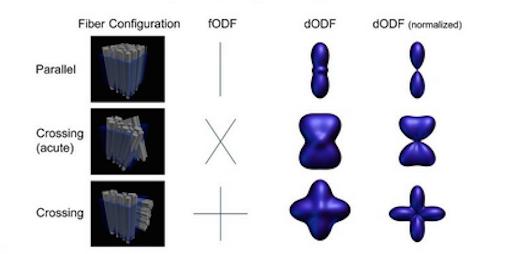 Figure 3.1: Orientation distribution functions corresponding to different white matter configurations. The normalized dodf highlights the directional characteristics of the original dodf. Credit: [1].