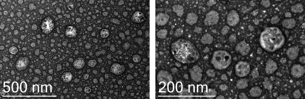 Transmission electron microscopy (TEM) The morphological characterization of the lipid-based magnetic nanovectors (LMNVs) was performed using a JEM-1011 TEM (W filament), operated at 100 kv.