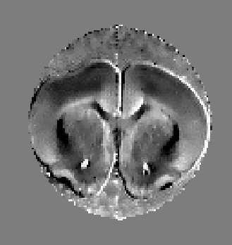 (b) Results of normal rat brain estimated
