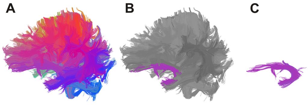 Voineskos et al. Page 10 Figure 1. (A,B,C). Whole brain clustering result and example of how white matter tract is selected (left uncinate fasciculus).