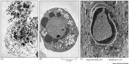 Detection of apoptotic cells l l l Microscopy l l Cells have classic features (eg.