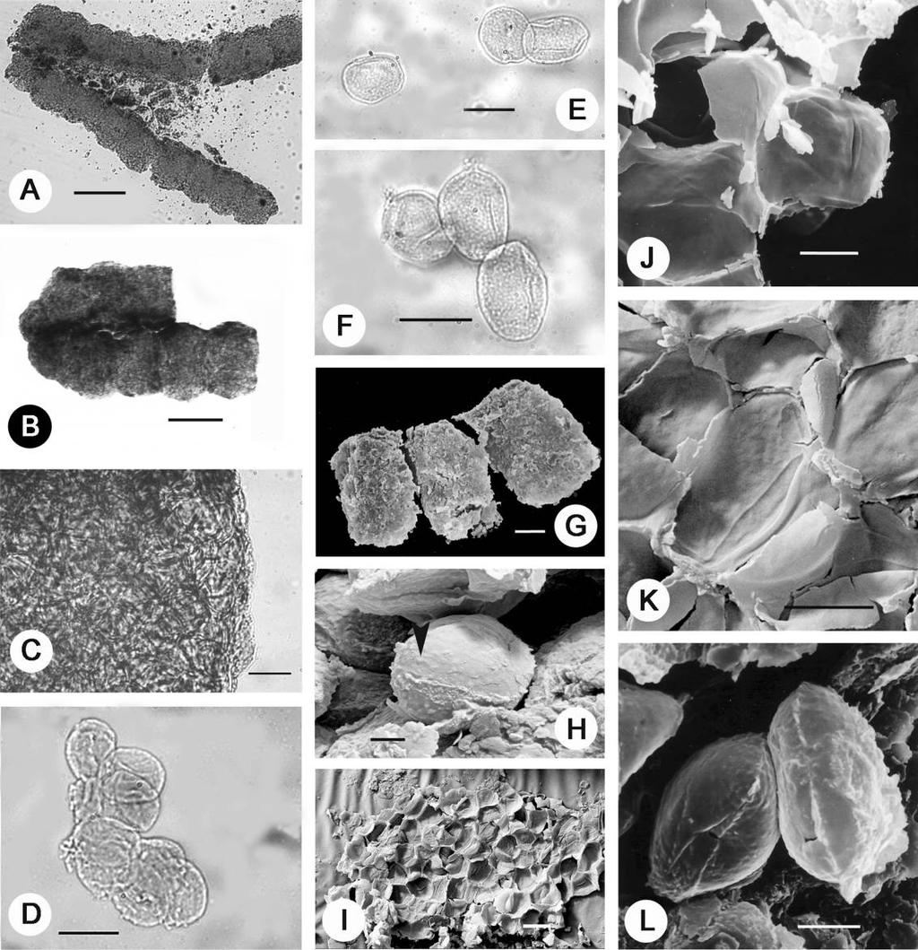 478 INTERNATIONAL JOURNAL OF PLANT SCIENCES Fig. 5 Marattia aganzhenensis sp. nov. synangia, sporangia, and in situ spores. A, Light micrograph of a synangium.