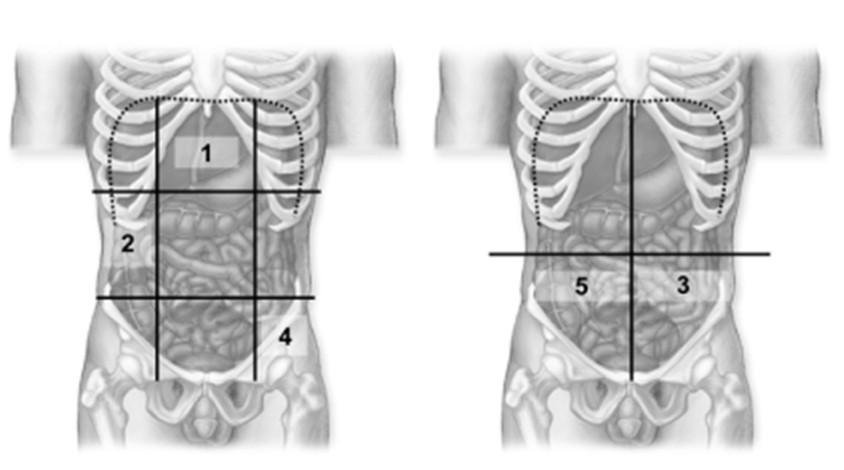 88. This figure shows a frontal view of a human. What does number 2 indicate? A. Pelvic cavity B. Pleural cavity C. Mediastinum D. Abdominal cavity E. Cranial cavity Figure: 01.
