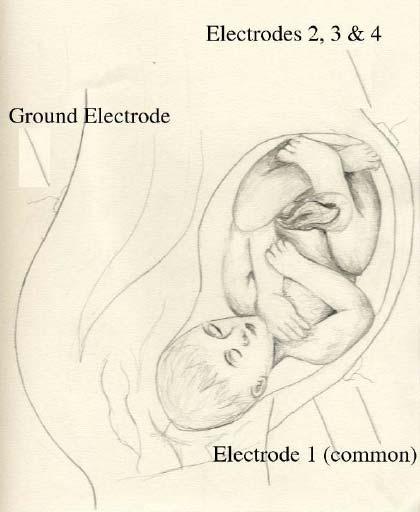 Fetal ECG lab