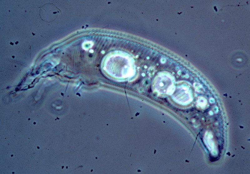 Eriophyiid mites: plant feeders, some