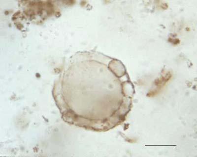 Microfossil from Gunflint Chert, Western Ontario (north
