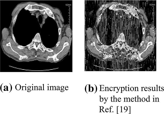 We aim to improve an optimize this metho in combination with the inherent characteristics of a meical image.