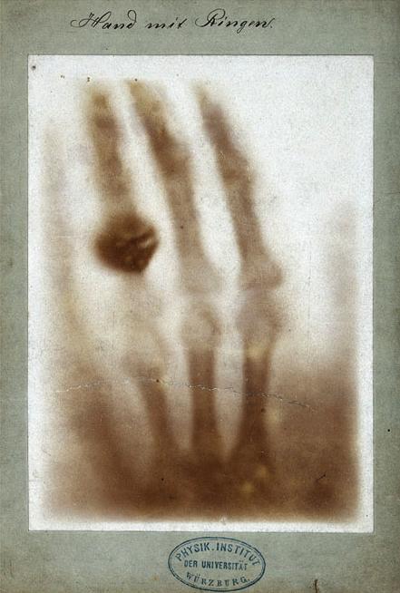 X-ray imaging: