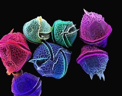 Where do you think you d find it in your natural world? 6. What is unique about Dinoflagellates (image below)? 7. Are they unicellular?