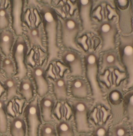 Figure 3: stomata of Carex acuta with magnification 500.