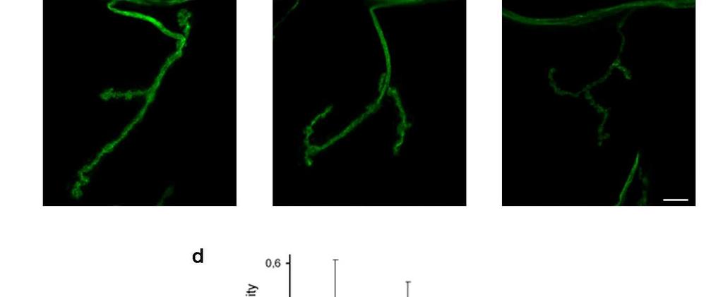 neuron bodies revealed with plasma membrane localized