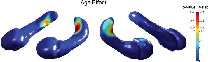 Chung et al. Page 12 Fig. 5. T-statistic and corrected p-value maps on the amygdala/hippocampus template showing age effect.