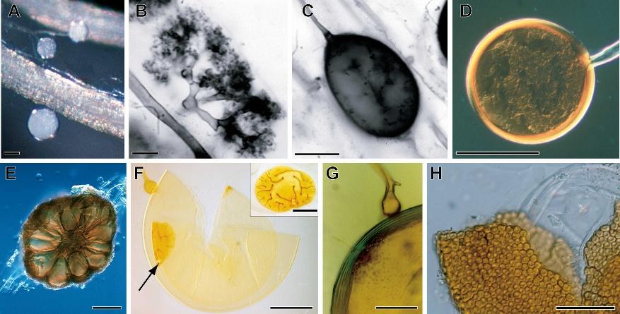 886 MYCOLOGIA FIG. 1. Some characteristic morphological features of glomeromycotan fungi. A. Colonized roots of Plantago media with hyphae and spores of Glomus clarum. B.