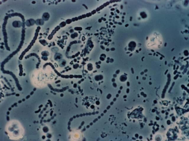 Organisms in Kingdom Archaebacteria are unicellular prokaryotes. They have no membrane bound nucleus or organelles in their single celled bodies.