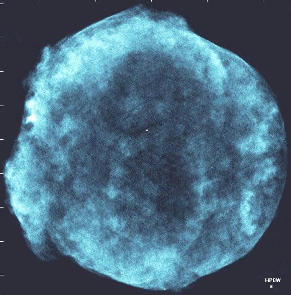 VLA radio image of Tycho SNR Shock
