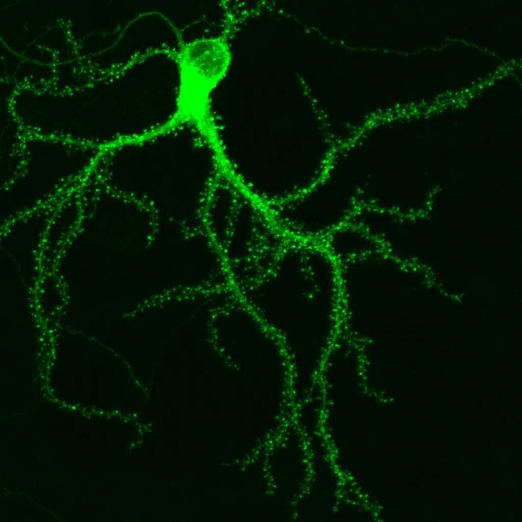 Neuron: Basic Brain Processor Neurons are nere cells that transit signals to and fro