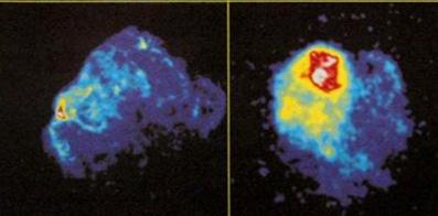 - Old SNRs in X-rays Old Supernova Remnants 2/5 Einstein Obs.