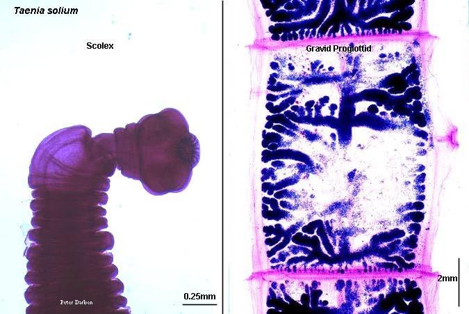 Class Cestoda The class Cestoda consists of the tapeworms, an example of which is shown in Figure 22.