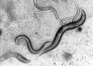 One nematode, Caenorhabditis elegans, has only one thousand genes in its genome and its developmental pathways are well known. C. elegans serves as a model for eukaryote gene systems and has been extensively studied as part of the human genome project.