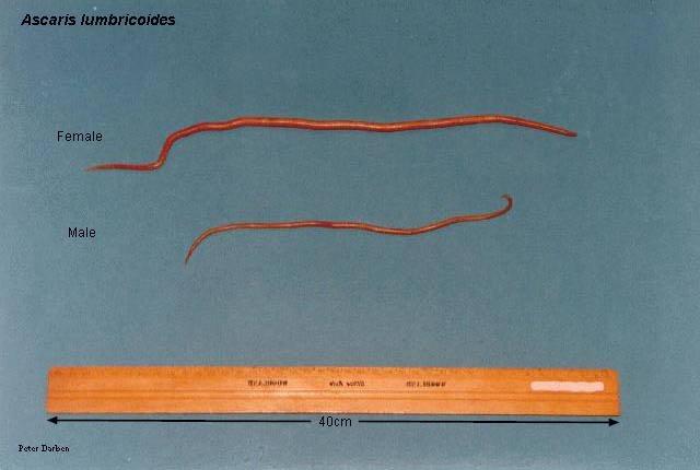 Humans contract Trichinella (the roundworm that causes the disease trichinosis, illustrated in Figure 26) by eating raw pork containing encysted larvae.
