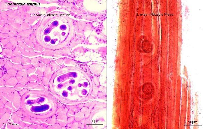 . Filarial worms cause various diseases. Dirofilaria, shown in Figure 27, causes heartworm in dogs, and is a common filarial worm in temperate zones. Figure 27. Dirofilaria immitis, a filarial worm, in dog's blood and lung.