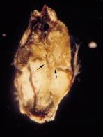 Sclerotial tissues are compact and white internally with a thin, redbrown rind (arrow).