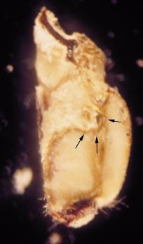 Figure 9. Longitudinal section of immature sclerotial tissues with sphacelial tissues on top.