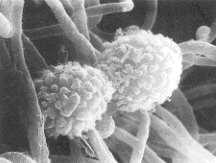 Actinomycetes funguslike, filamentous bacteria, huge numbers in soil; second only to regular bacteria Historically classified as fungi misnomer Specialized group of soil bacteria (unicellular, no