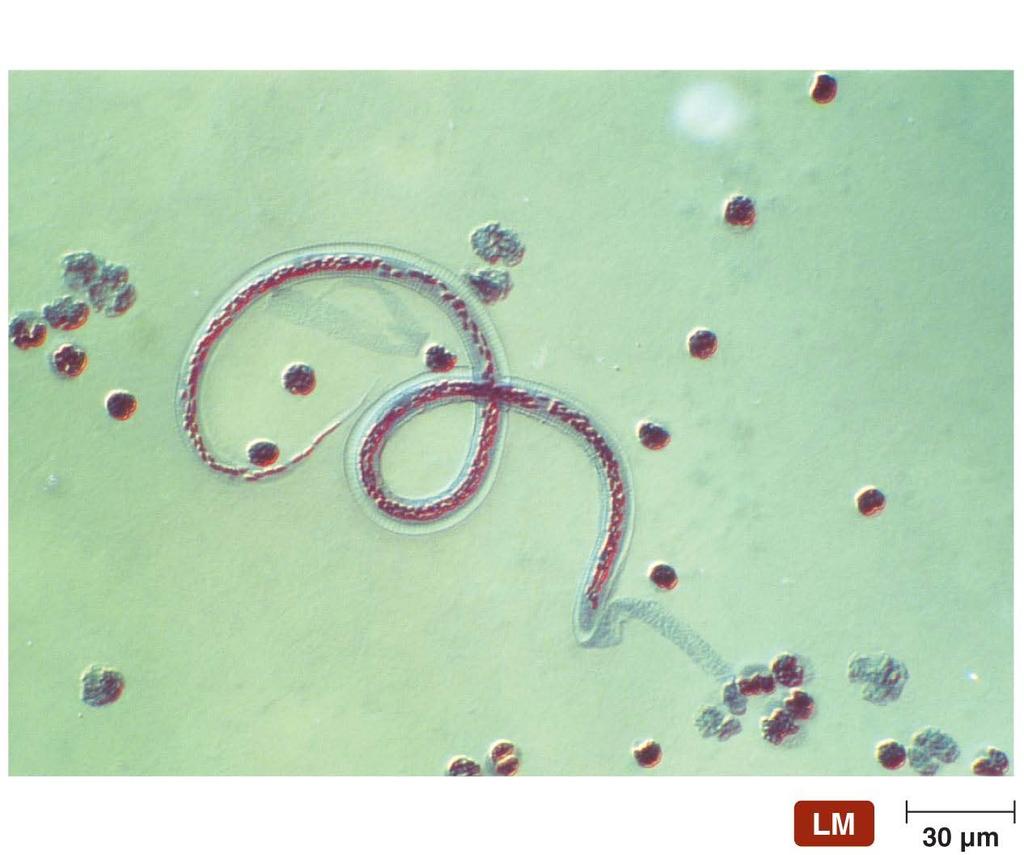 Figure 1.8 An immature stage of a parasitic worm in blood.