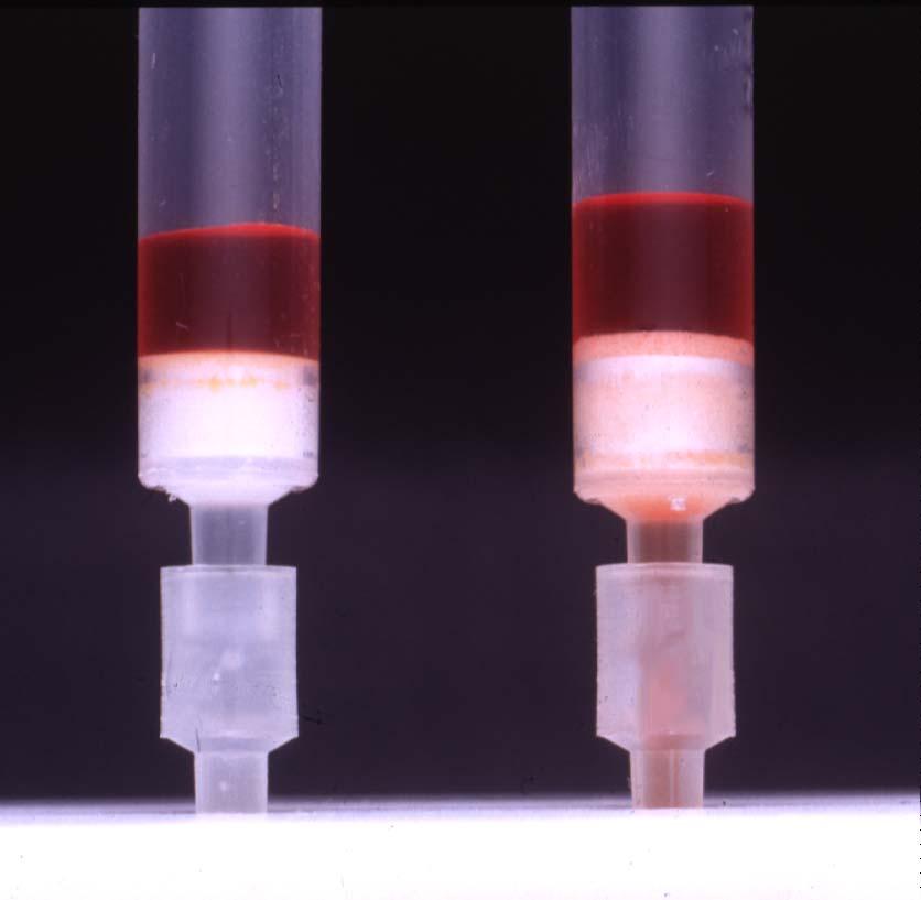 Comparison of Dye Retention: HLB vs. C 18 Shown in picture are two cartridges that have been conditioned with 1 ml of methanol and then dried for 5 minutes with vacuum (0.4 bar).