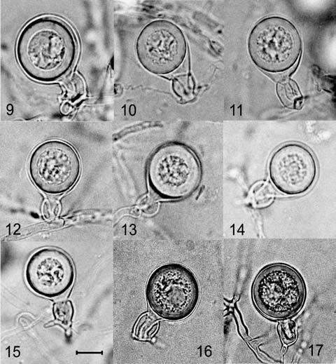Phytophthora kernoviae sp. nov., an invasive pathogen 856 Figs 9 17. Representative oogonia, antheridia and thick walled plerotic oospores of Phytophthora kernoviae.