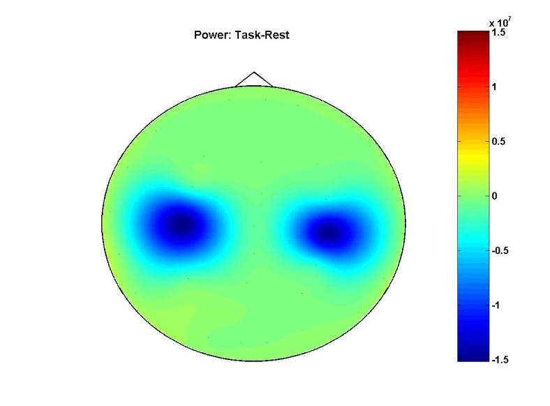 EEG-simulation of ERD (two sources) Rest: Real background + simulated dipoles Task: Real